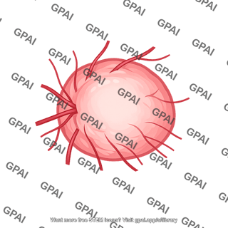 Optic disc edematous