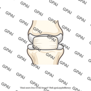 Palmar ligament interphalangeal joint
