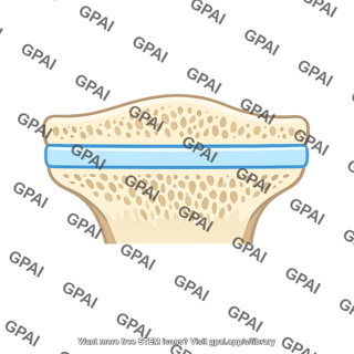 Growth plate