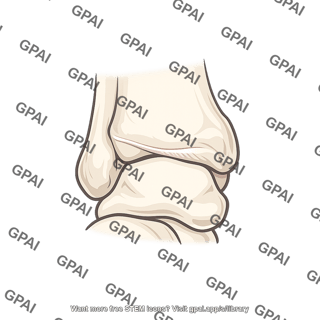 Anterior malleolar fold