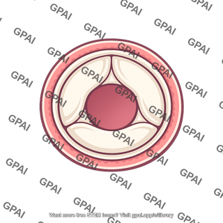 Aortic orifice