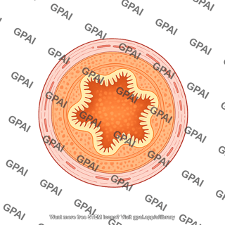Intestine cross section jejunum