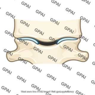 Uncovertebral joint
