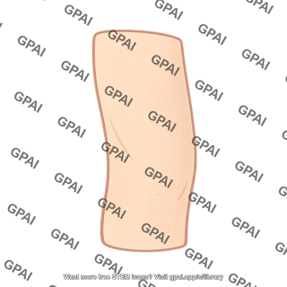 Lateral leg skin