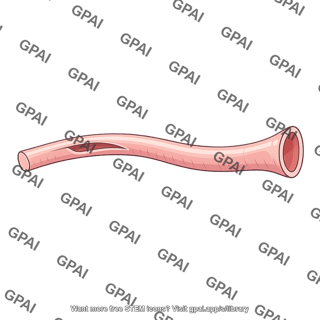 Cartilaginous part of pharyngotympanic tube