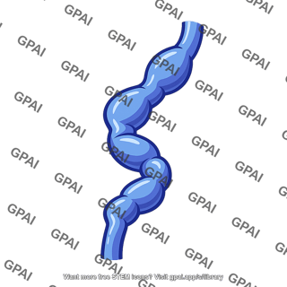 Distended vein