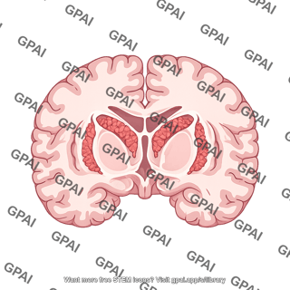 Brain horizontal cut at thalamus with choroid plexus