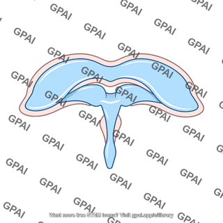 Cerebral ventricle
