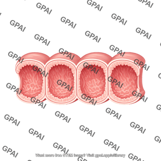 Large instestine cross section