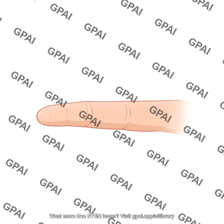 Finger palmar view