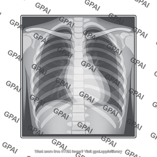Chest radiograph