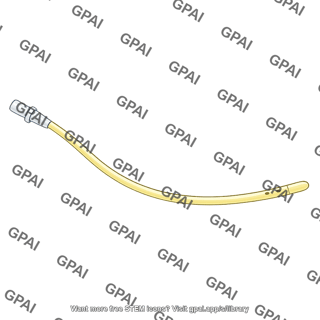 Nasogastric tube