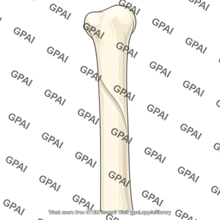 Radial groove
