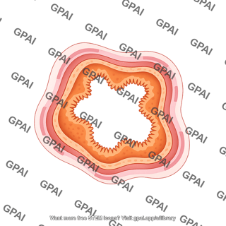 Intestine cross section colon