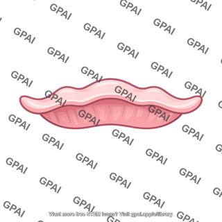 Crescent mucosal fold