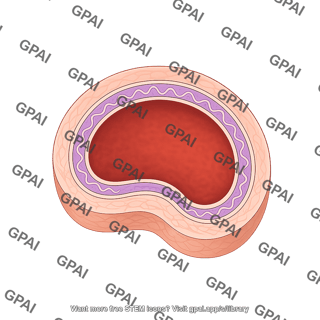 Vessel cross section muscular artery internal elastic membrane