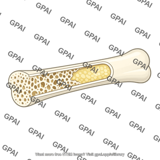 Bone cutaway