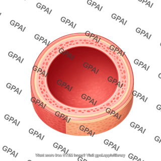 Artery cross section dilated