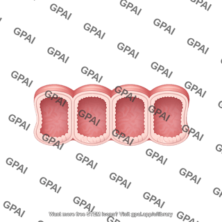 Large intestine cross section