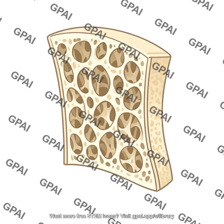 Osteoporotic bone