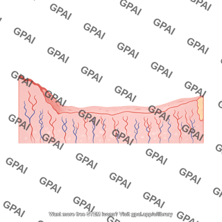 Endometrium first suppressed menstrual cycle
