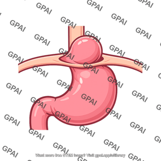 Hiatal hernia