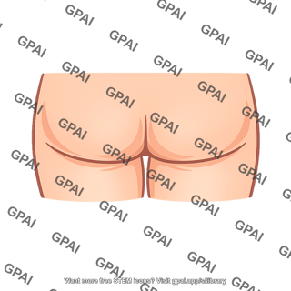 Gluteal fold
