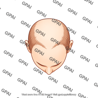 Male balding stage 1 superior 500
