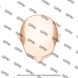Male balding bald superior 980
