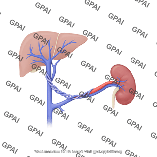 Portal vein human in situ distal splenorenal shunt