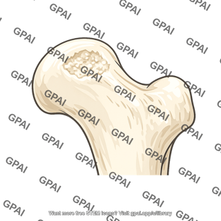 Piriformis impression