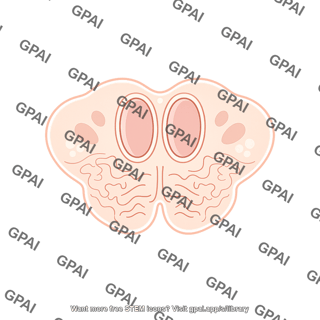 Brainstem cross section medulla vestibular nuclei