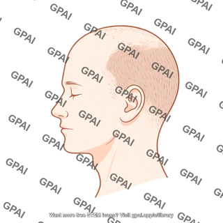 Male balding stage 2 lateral 581