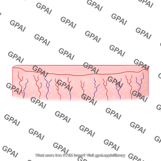 Endometrium suppressed menstrual cycle