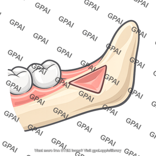 Retromolar triangle