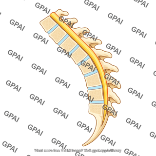 Lumbar bent forward 303
