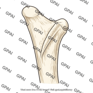 Proximal ulna