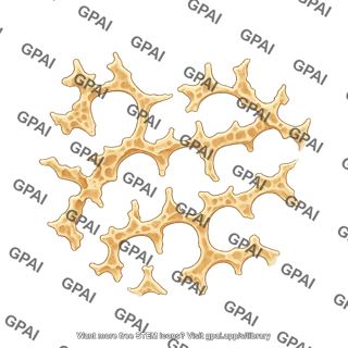 Bone osteoporosis trabeculae schematic
