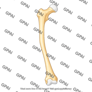 Femur anterior coxa vara