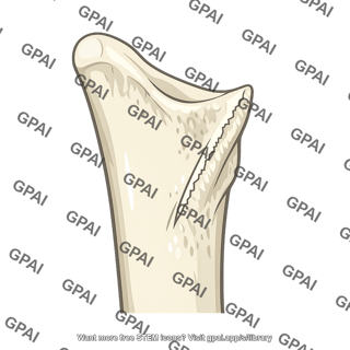 Supinator crest of ulna