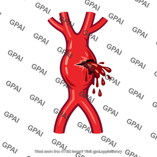Abdominal aortic aneurysm ruptured
