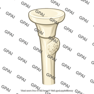 Radius proximal end