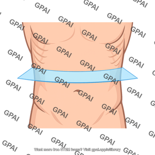 Subcostal plane