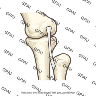 Fibular collateral ligament