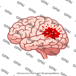 Hemorrhagic stroke