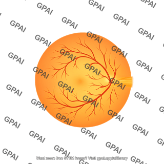 Eye retina