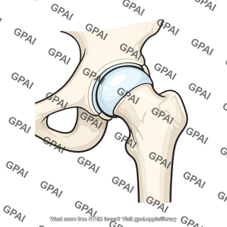 Hip joint