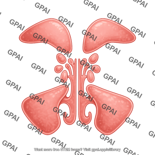 Paranasal sinuses anterior view 1