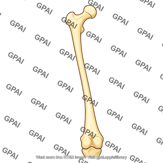 Femur anterior coxa valga 200