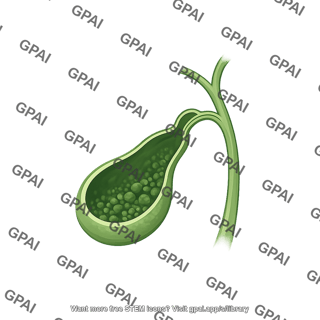 Gallbladder cut